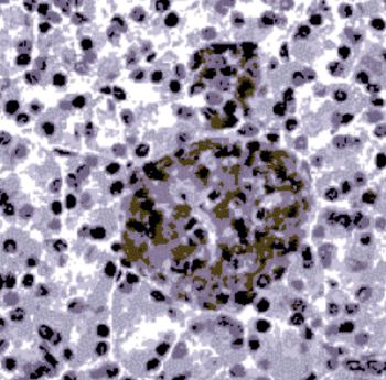 Image: Human pancreas stained with anti-glutamic acid decarboxylase 65 antibody (Photo courtesy of Mybiosource).